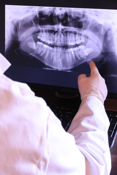 Best Emergency Wisdom Teeth Removal in Missouri Valley, IA